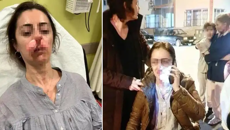 Otomobil Kapısı Korkutan Silah Haline Geldi: Eşinin Sevgilisiyle Yüzleşme Anı