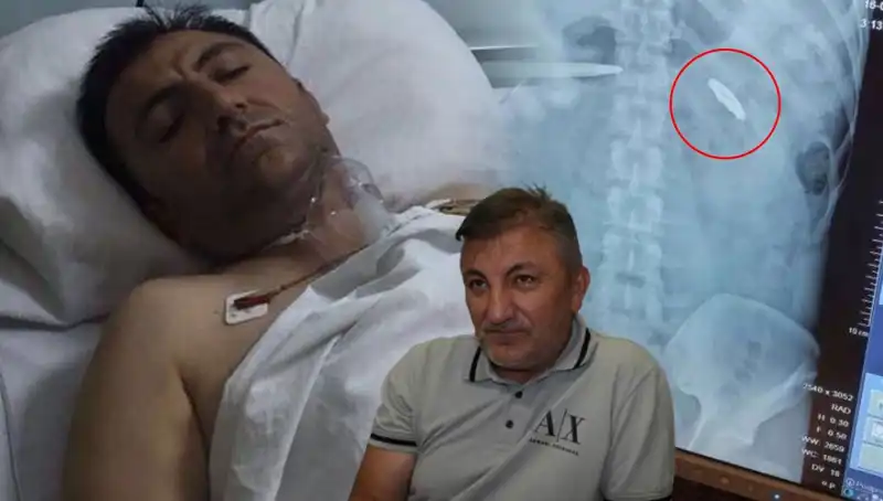 15 Temmuz Gecesi: Vücudunda Kurşunla Taşıdığı Acı Miras 9 Yıl Sonra