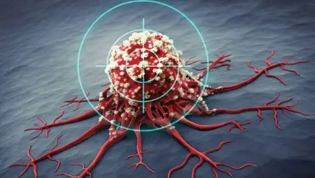 Prostat Kanserine Karşı Savaş: 6 Besin Etkisini Bilimle Kanıtladı