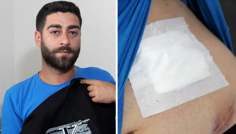 Karnında Hissettiği Ağrı Sonrası Korkutucu Gerçek Röntgende Ortaya Çıktı