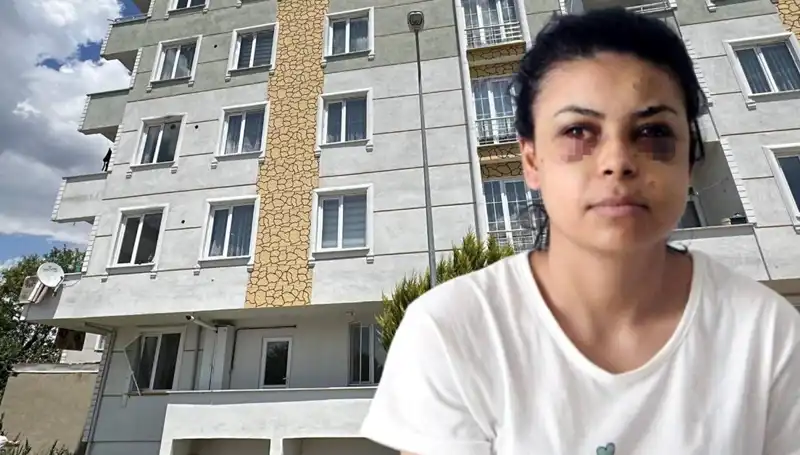 Düğünde Maganda Dehşeti: Saçmalar Gözüne Isabet Eden Genç Kadın Hastaneye Kaldırıldı