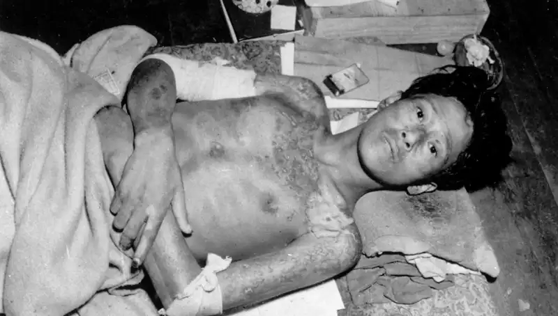 80 Yıl Sonra Nagasaki: Nükleer Tehlikeye Dikkat Çekiliyor