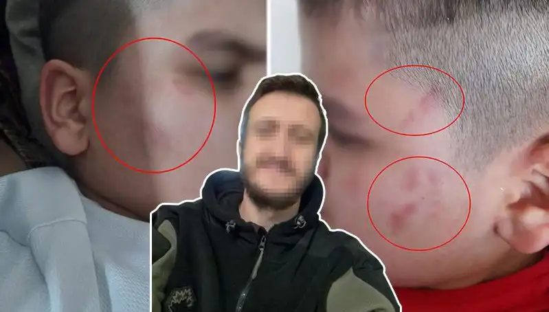 Otizmli Çocuğa Okulda Dayak İddiası: Aile Harekete Geçti
