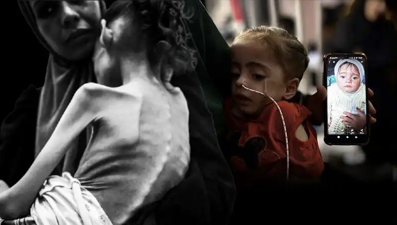 Küçük Meryem'in Hikayesi: 25 Kilodan 10 Kiloya Düşüşü ile Açlıkla Mücadelesi